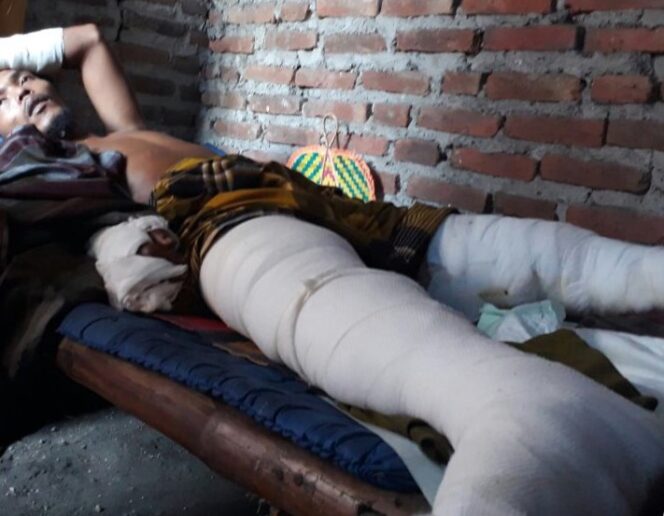 
Lima Warga Kakinya Melepuh Usai Terperosok ke Lokasi Pembuangan Limbah di Raci