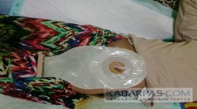 
Belum Ada Bantuan Pemerintah, Anak Sakit Kelainan Usus Besar Ini Butuh Uluran Tangan