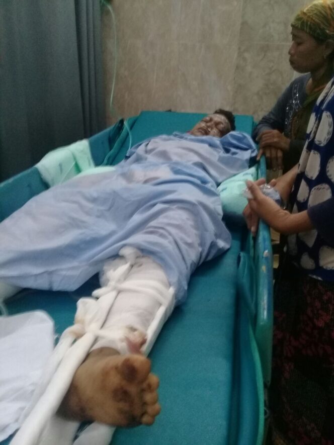 
Terkena Bondet, Dua Tangan Pemuda Pasrepan  Putus