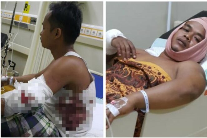 
Dua Warga di Pasuruan Jadi Korban Pembacokan yang Diduga Dilakukan Tetangganya Sendiri
